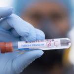 Coronavirus. Nuovo record contagi in Italia: oltre 31 mila. Le vittime sono 199
